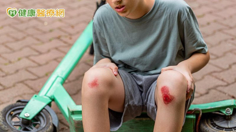 傷口癒合不是結束　預防疤痕從「這時機...