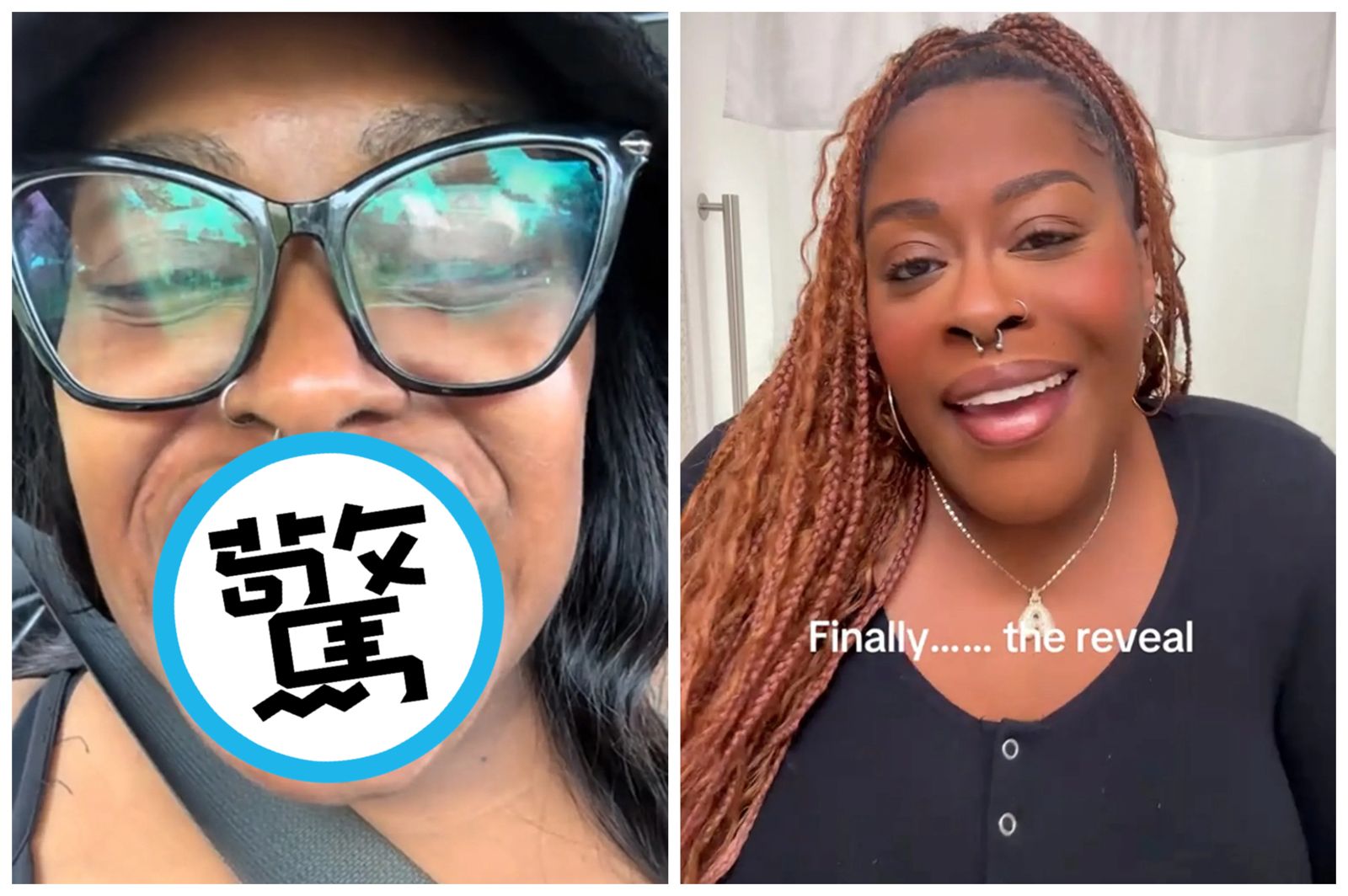 「沒徵兆卻掉光牙齒！」38歲媽媽遭霸凌　連陪孩子吃一頓飯都是壓力