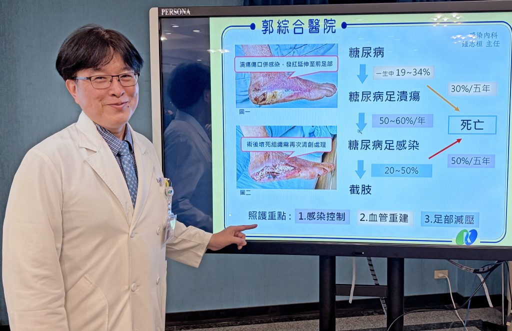 糖友足部潰瘍 嚴重感染恐截肢